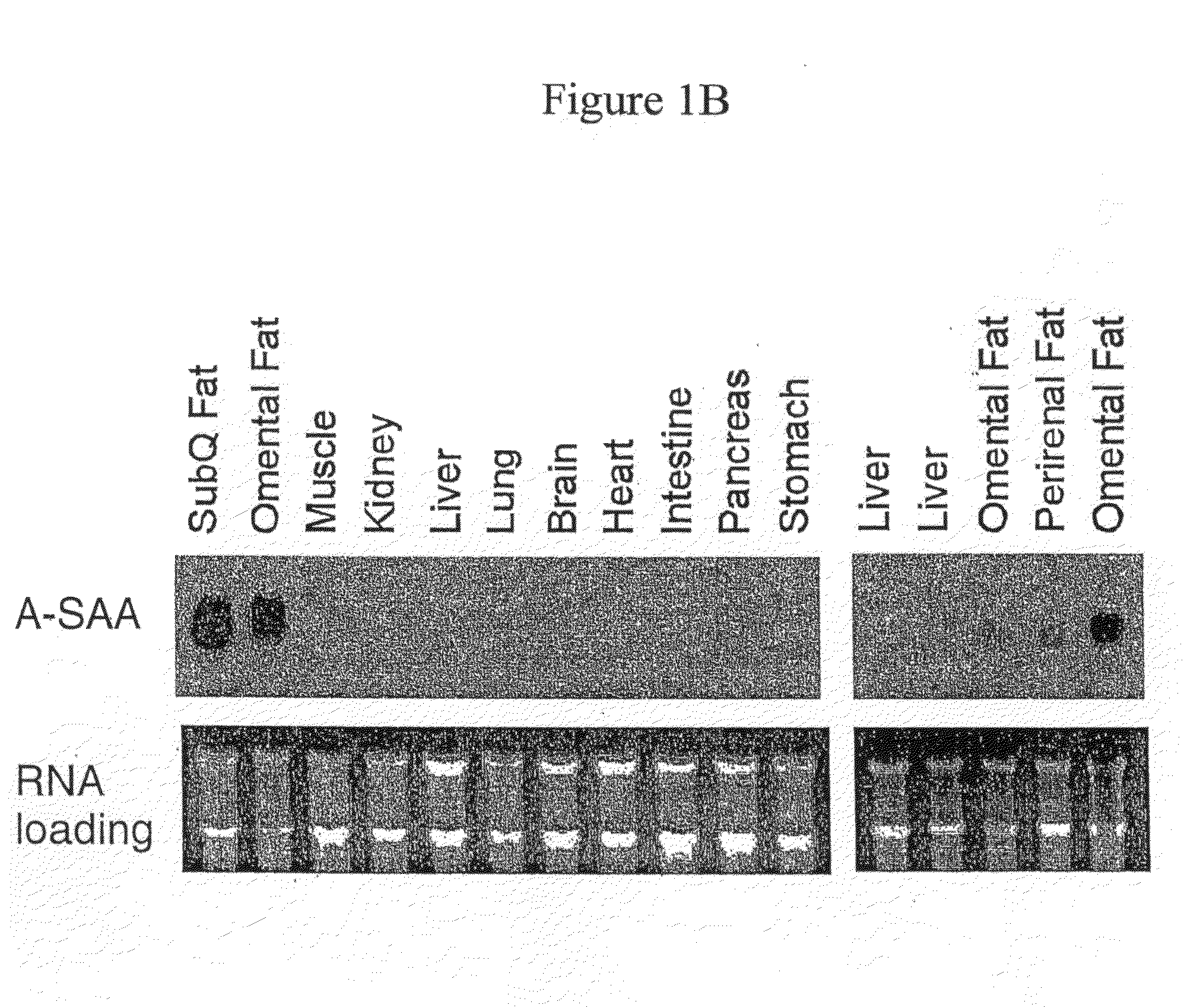 Serum amyloid a protein in inflammation and obesity