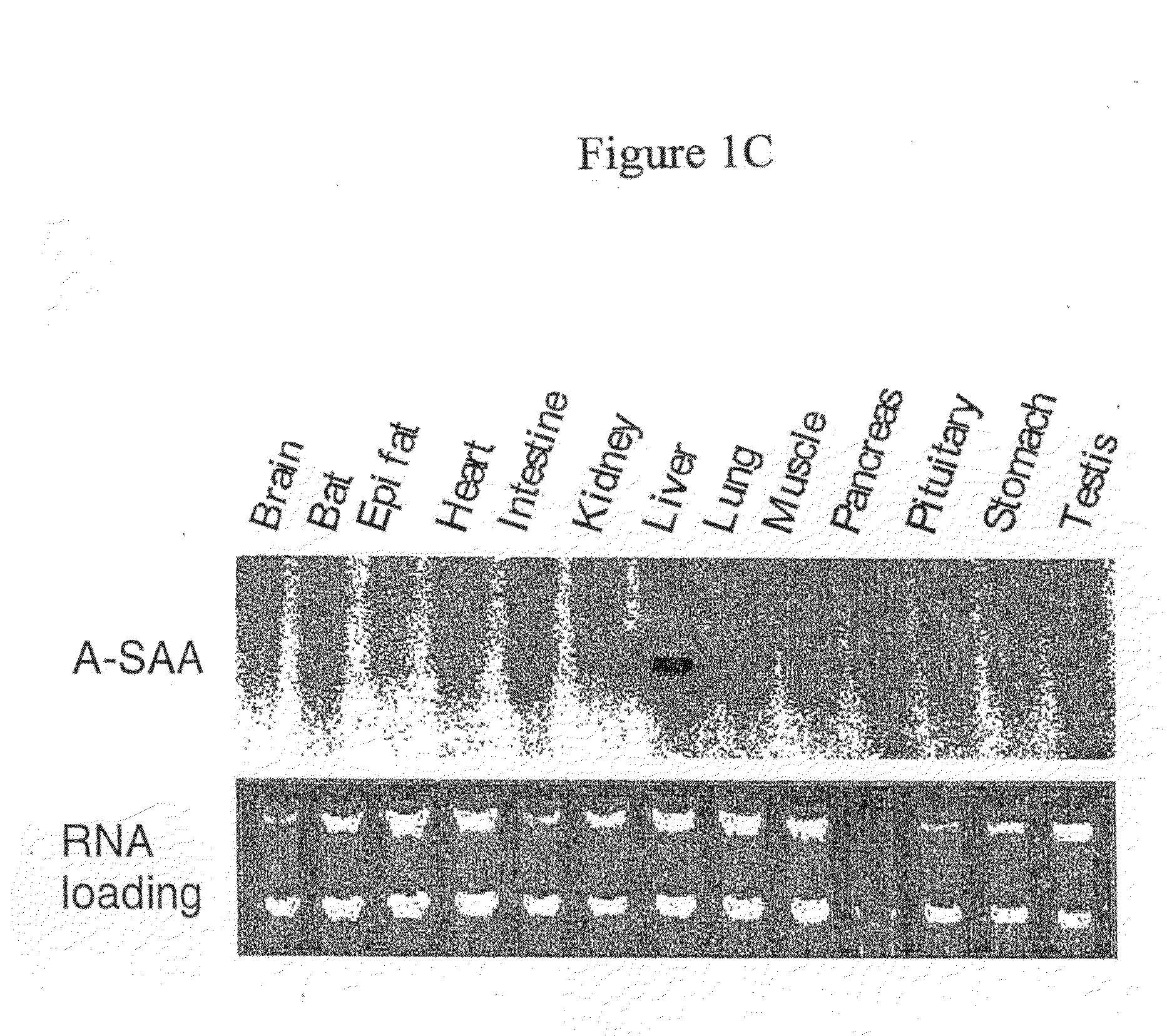 Serum amyloid a protein in inflammation and obesity