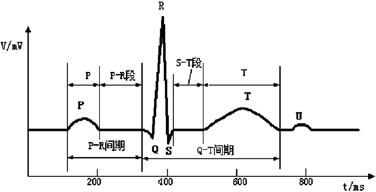 Two-electrode electrocardiographic lead intelligent positioning system