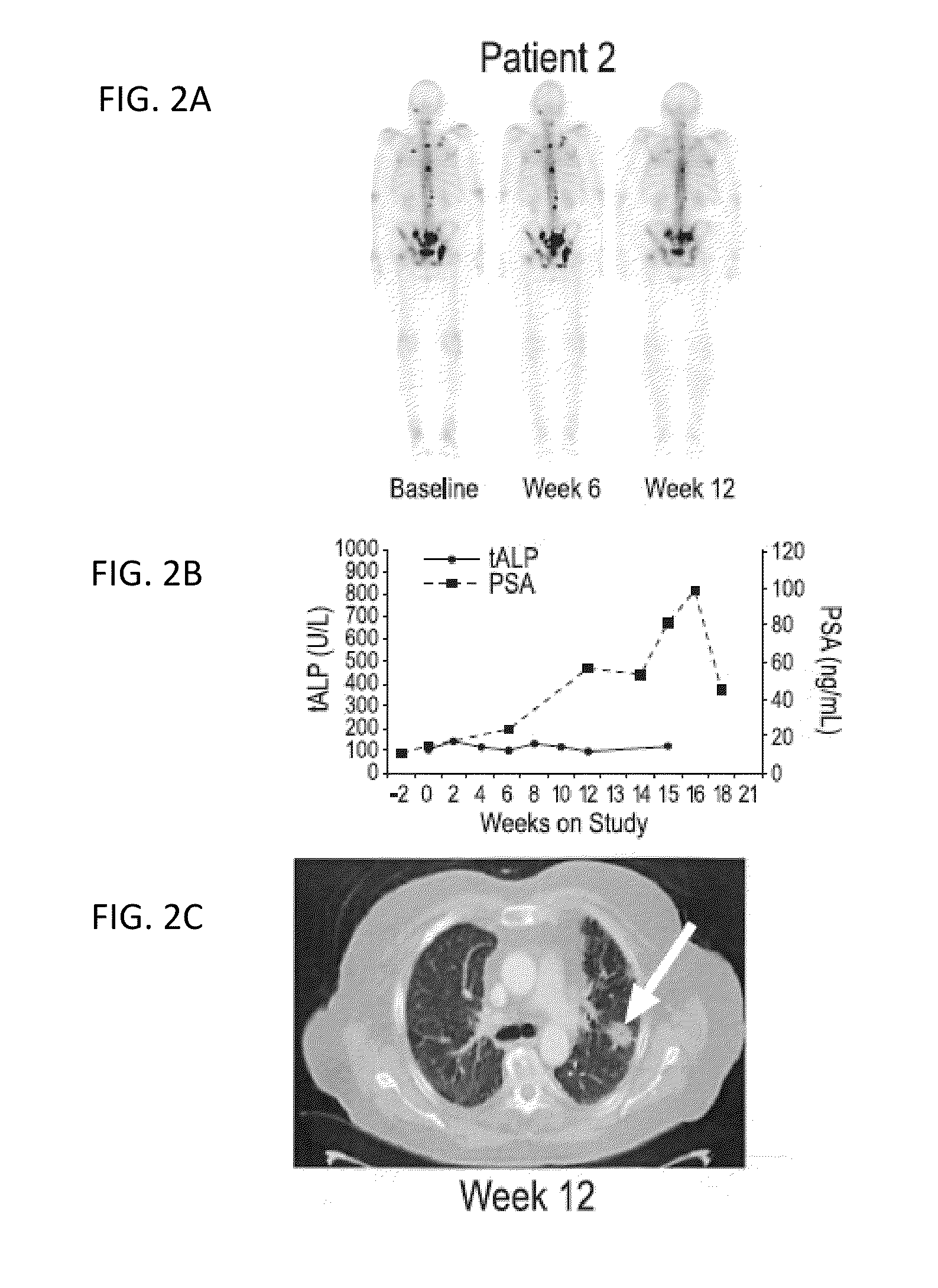 Method of Treating Cancer