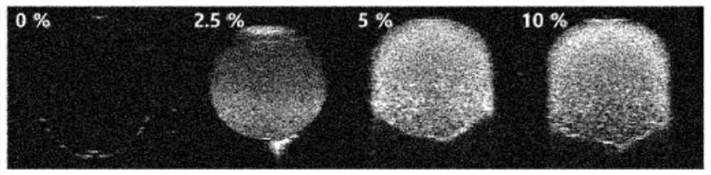 Bilirubin derivative-based diagnostic and therapeutic ultrasound contrast agent