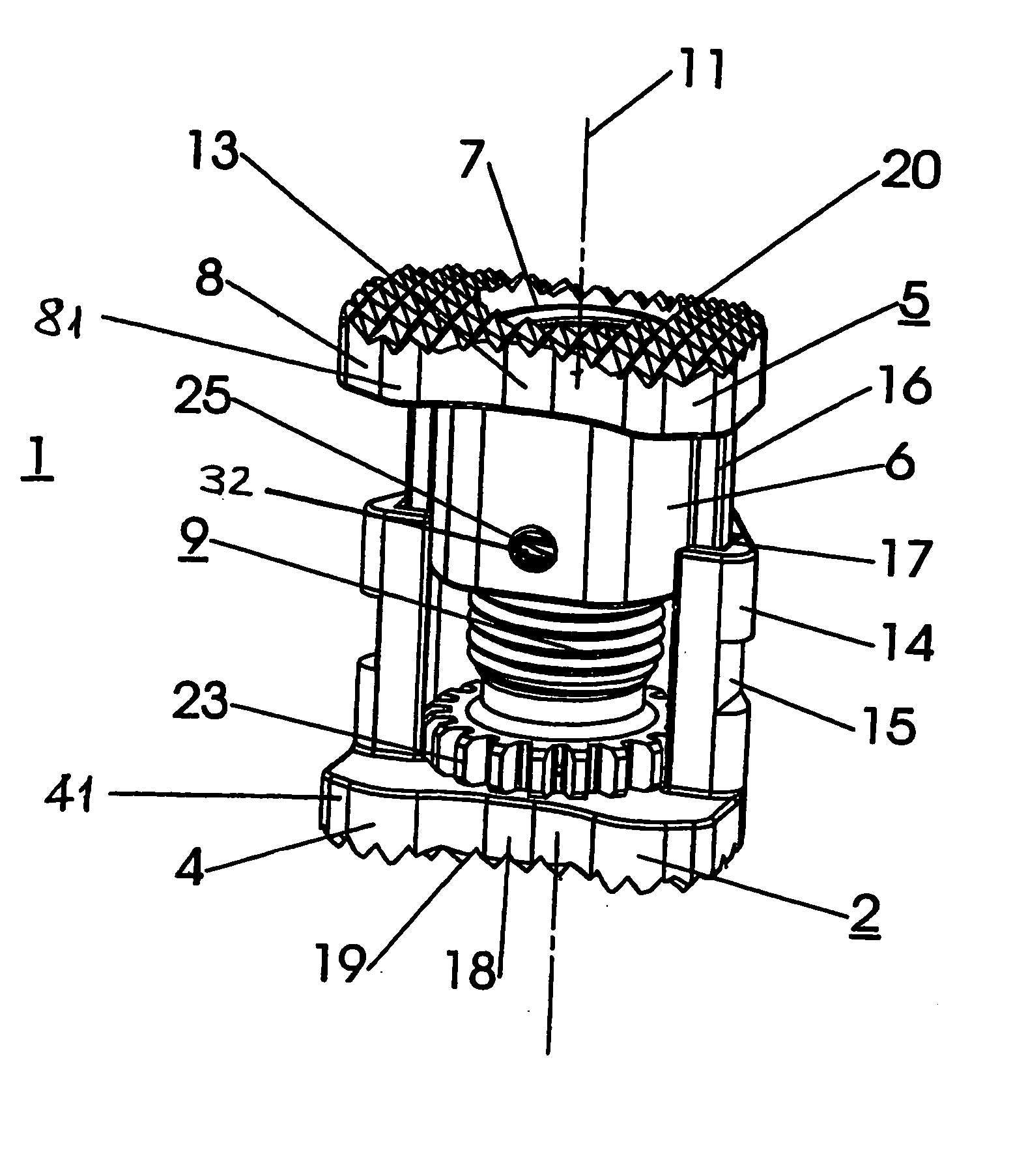 Intervertebral implant