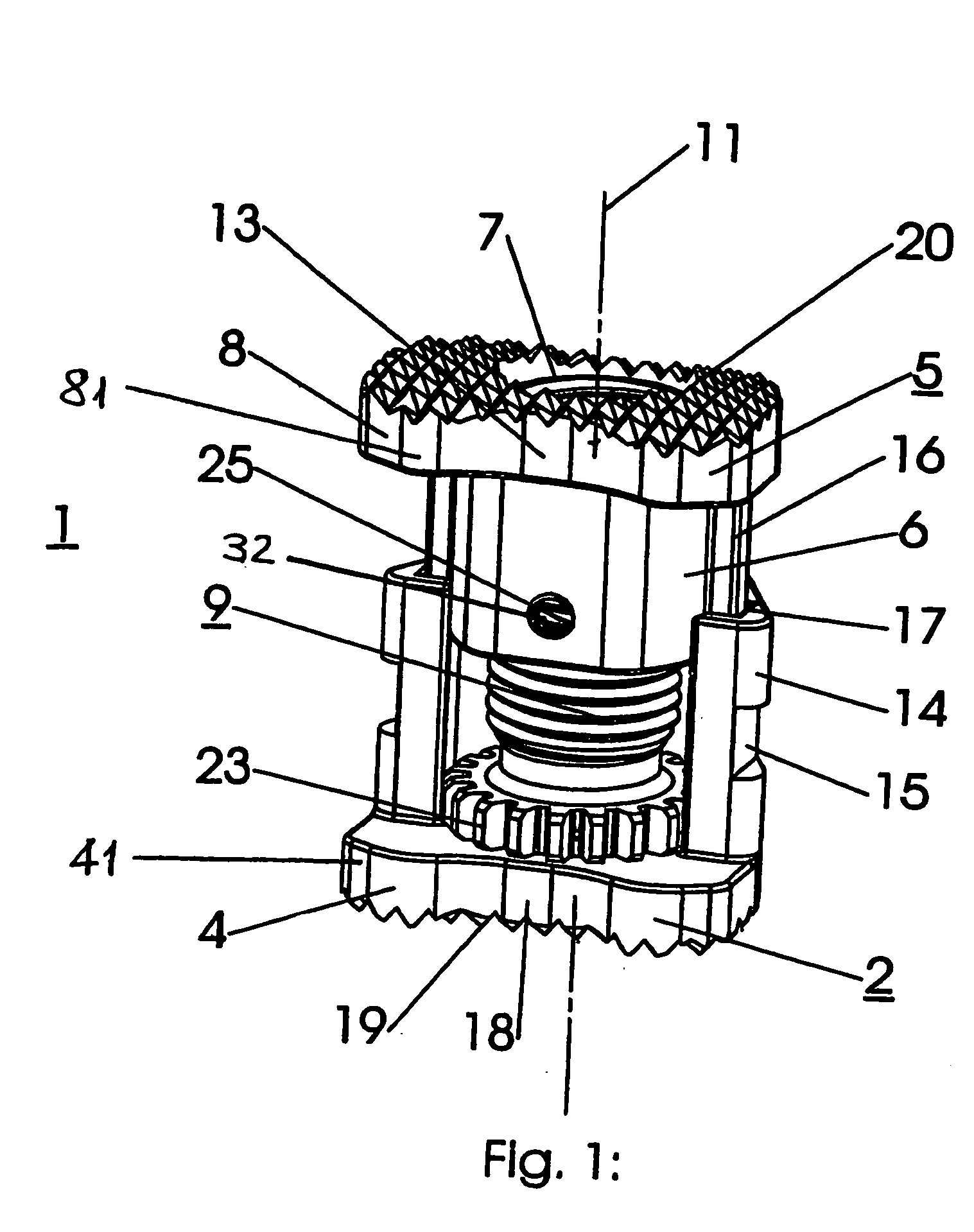 Intervertebral implant