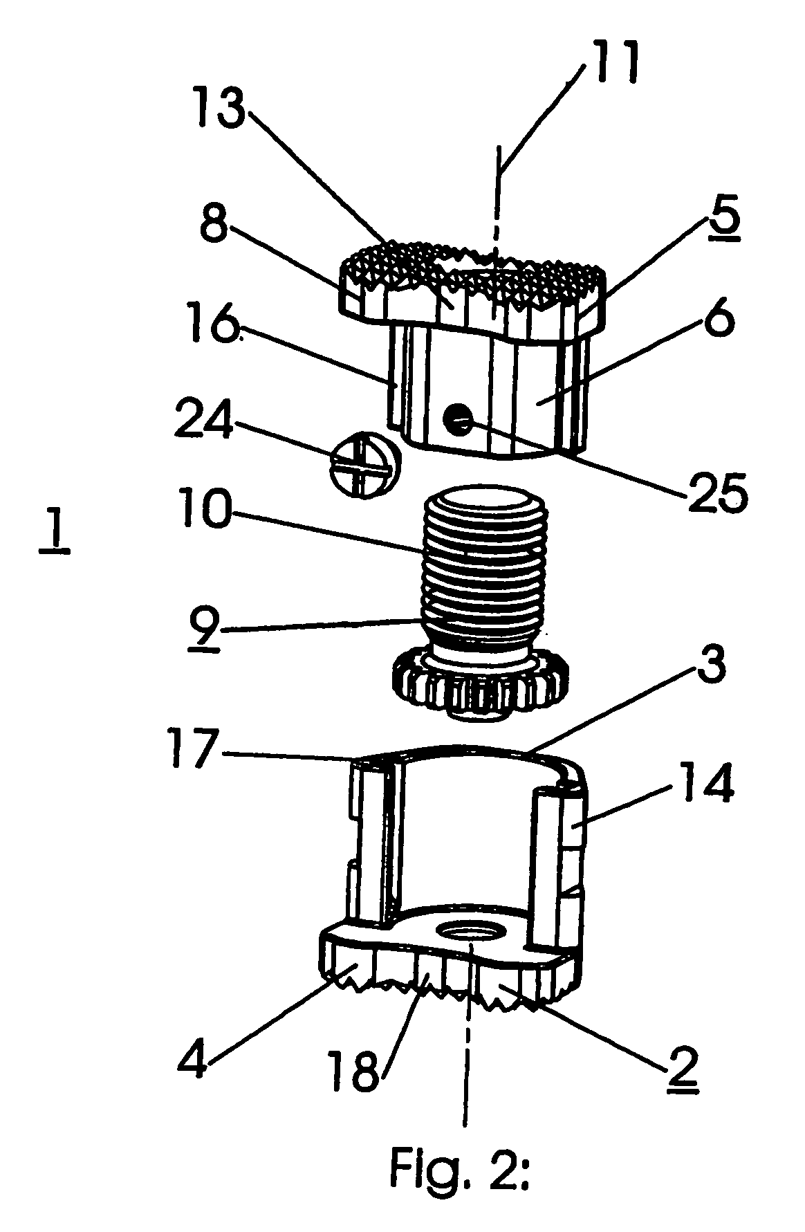 Intervertebral implant