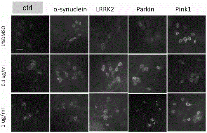 Application of MAPK (mitogen-activated protein kinase) signaling pathway inhibitor in preparation of PD (Parkinson's disease) treatment drug