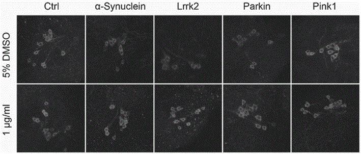 Application of MAPK (mitogen-activated protein kinase) signaling pathway inhibitor in preparation of PD (Parkinson's disease) treatment drug