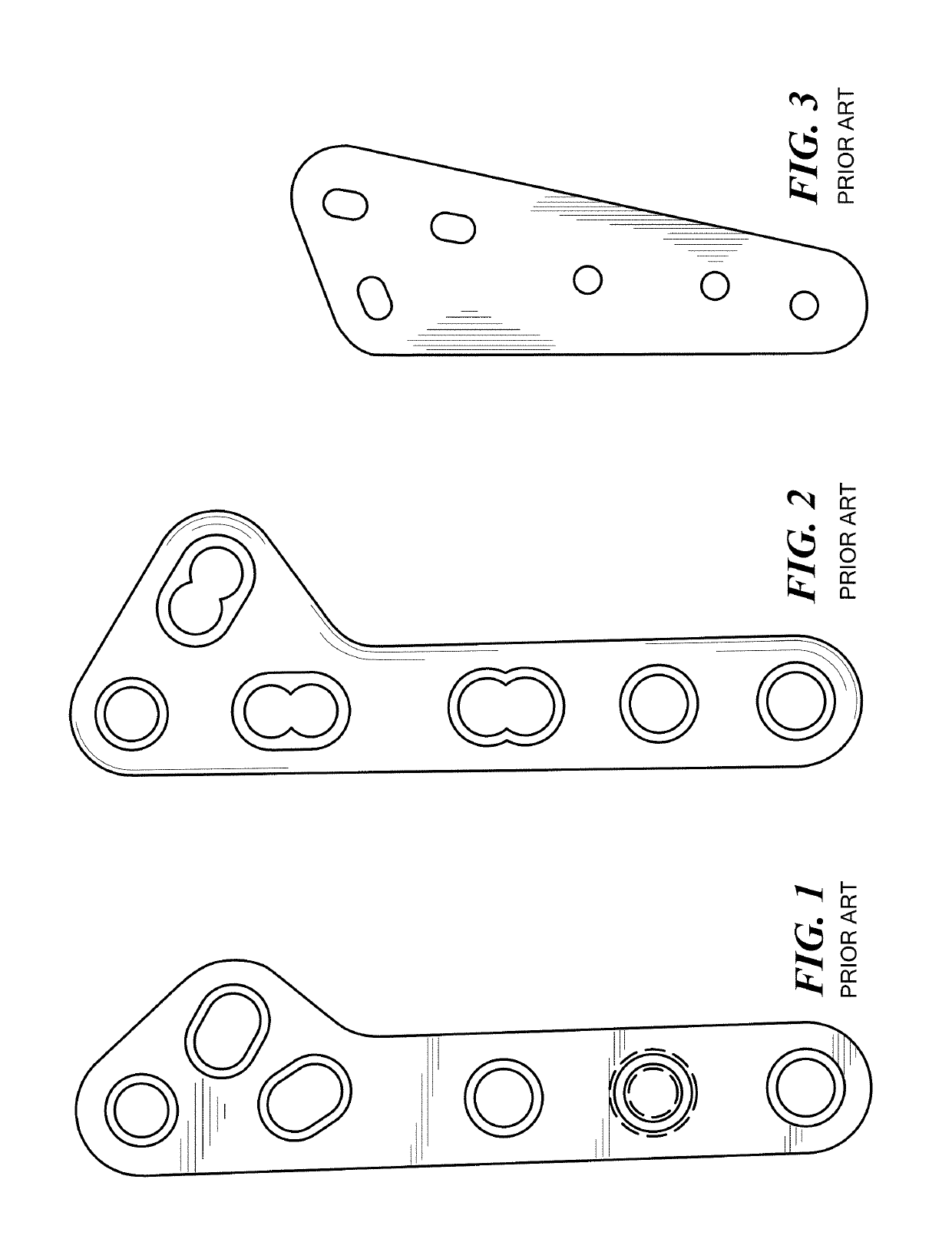 TPLO bone plate