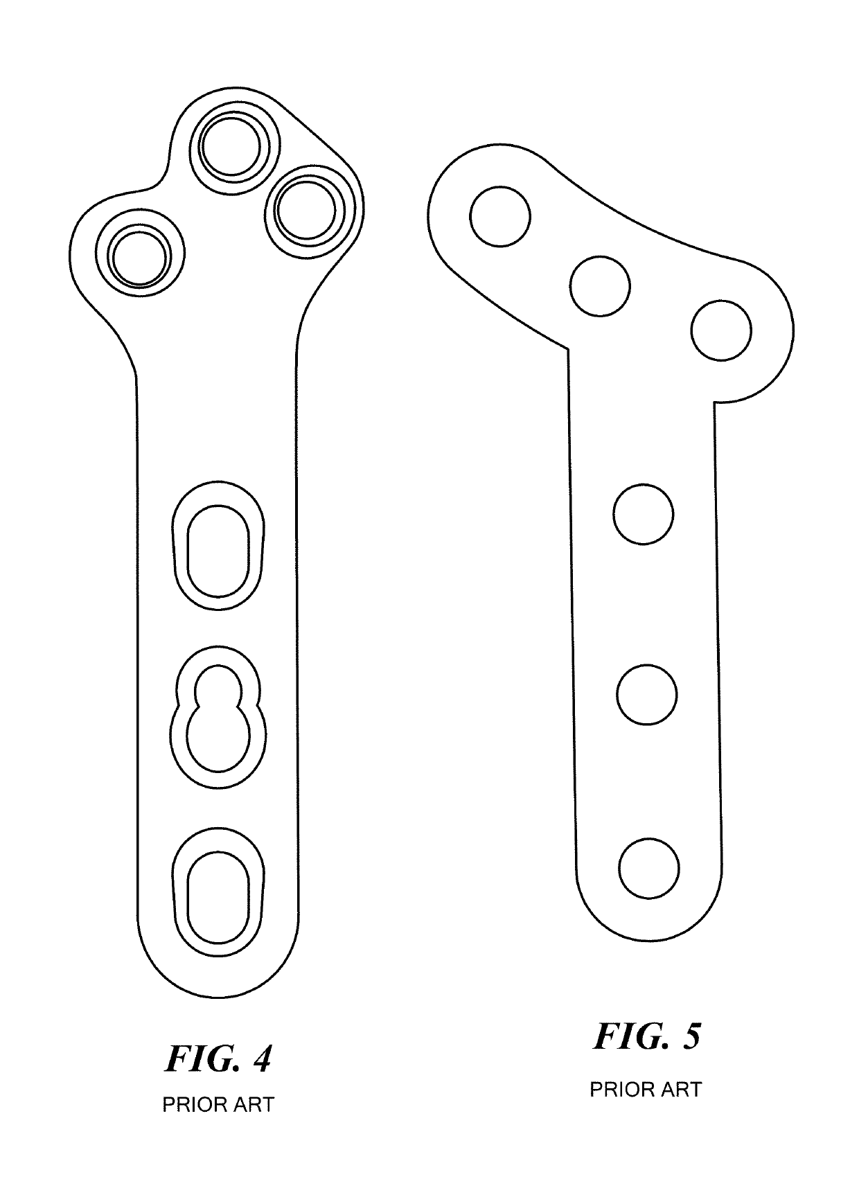 TPLO bone plate