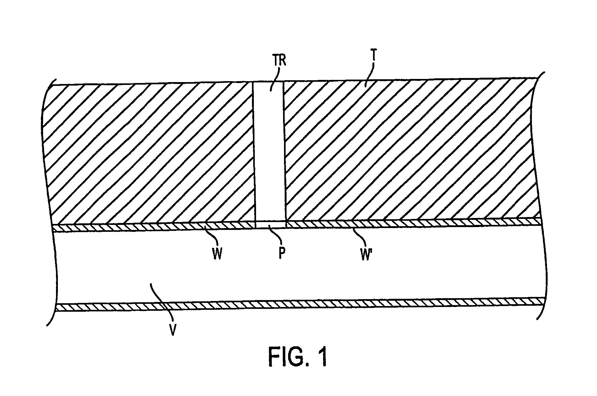 Apparatus for sealing a puncture by causing a reduction in the circumference of the puncture