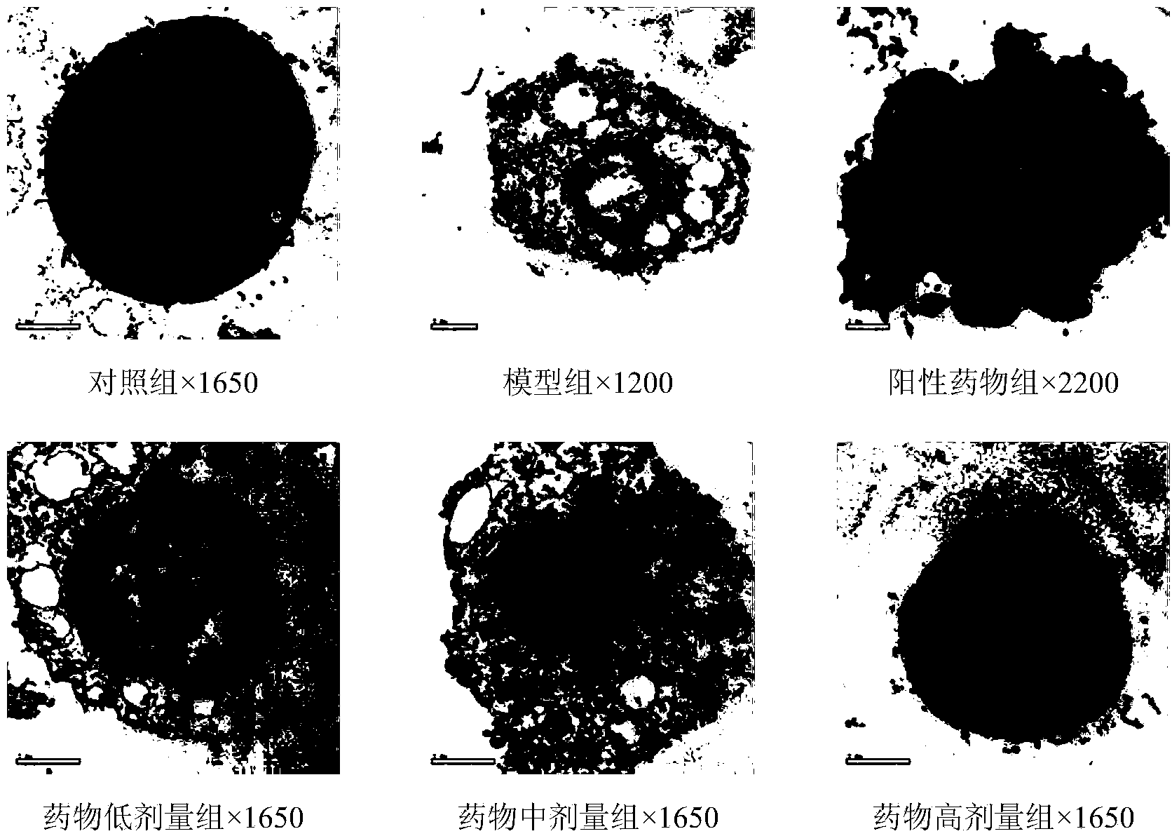 Application of cytochalasin H in preparation of Parkinson's disease resistant drugs