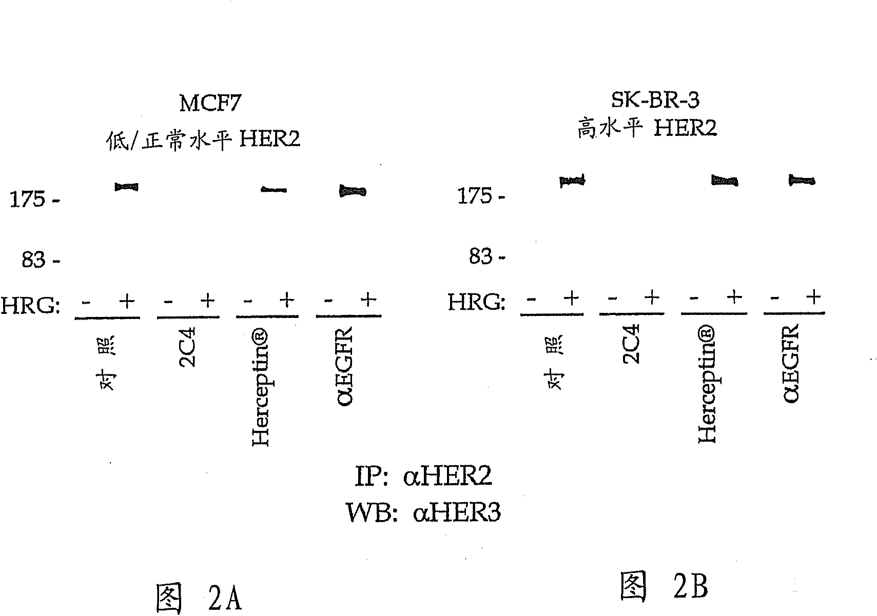 Method for identifying tumors responsive to treatment with anti-erbb2 antibodies