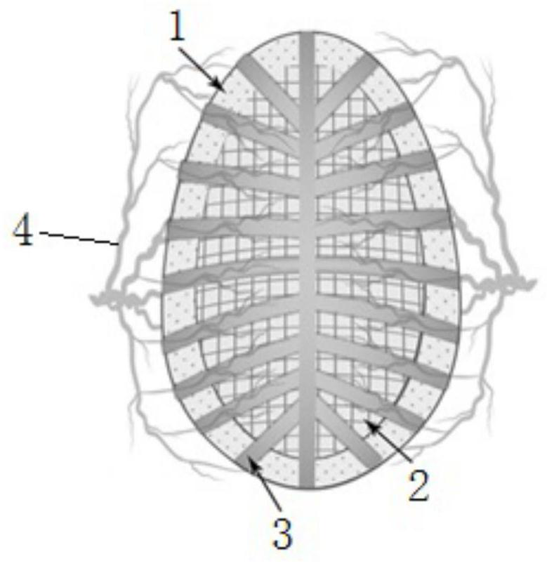 Layered bionic pore channel-porous composite scaffold