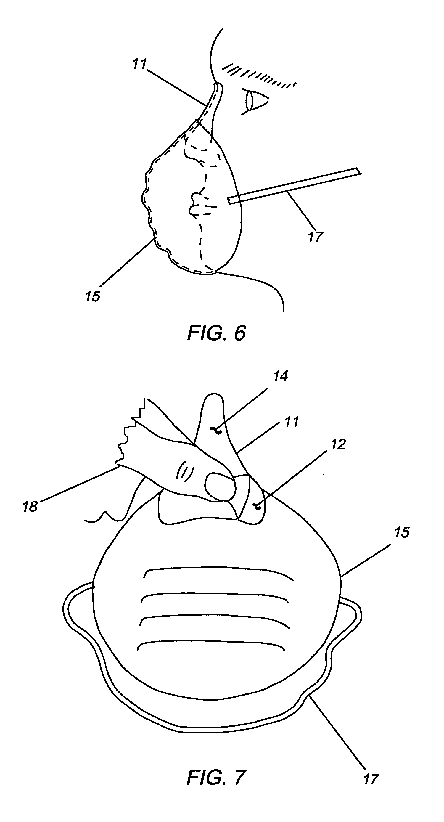 Face mask and method