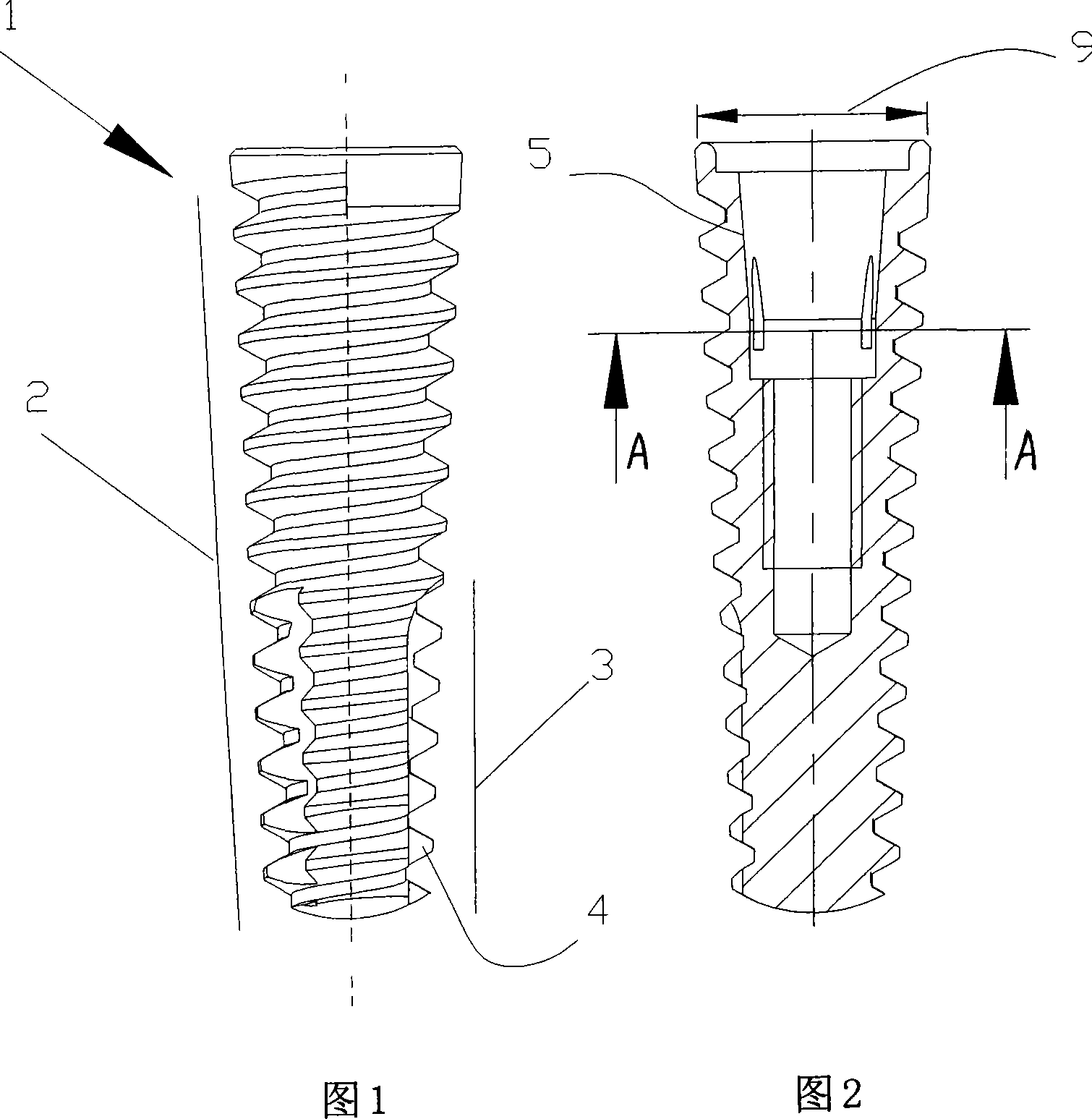 Mouth cavity planting body device