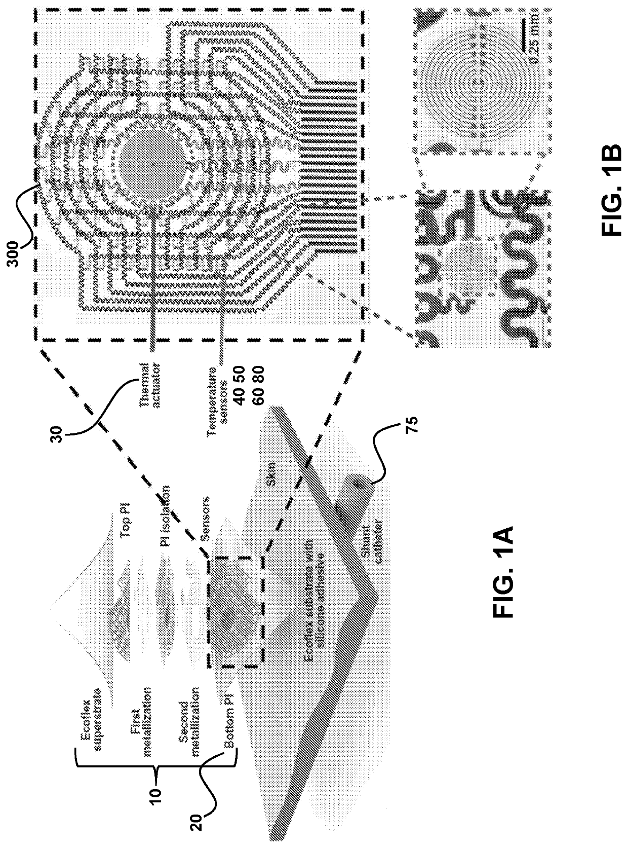 Wireless and noninvasive epidermal electronics