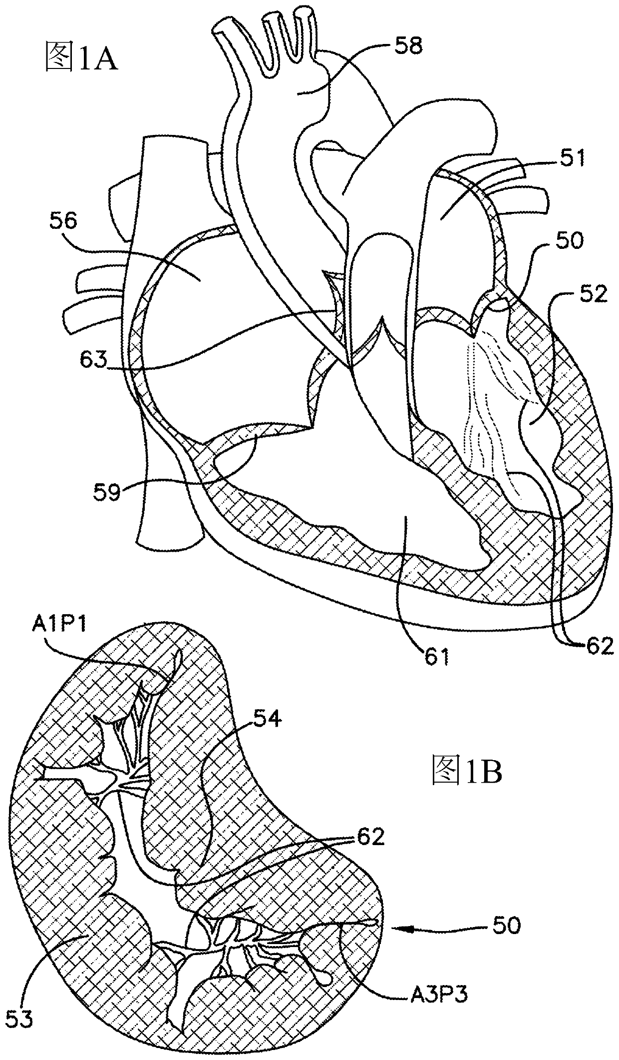 Deployment systems, tools, and methods for delivering an anchoring device for a prosthetic valve