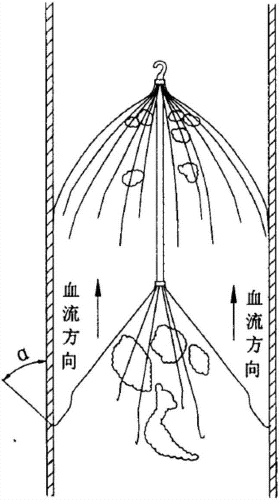 Vena cava filter of multilayer filtration