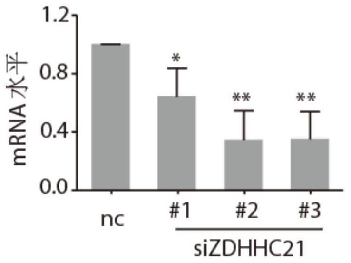 Application of zdhhc21 gene in preparation of medicine for inducing differentiation therapy of leukemia