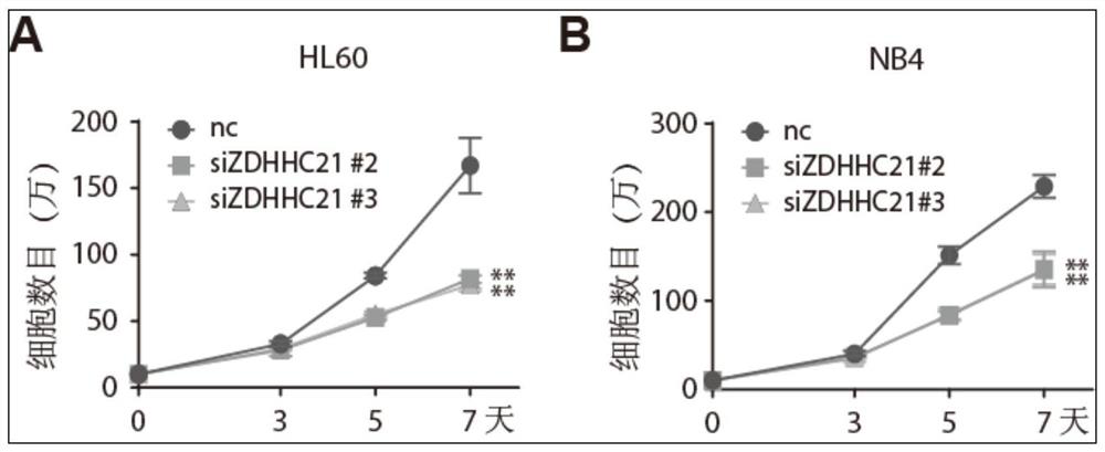 Application of zdhhc21 gene in preparation of medicine for inducing differentiation therapy of leukemia