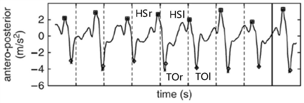 Acceleration-based gait event detection method and device