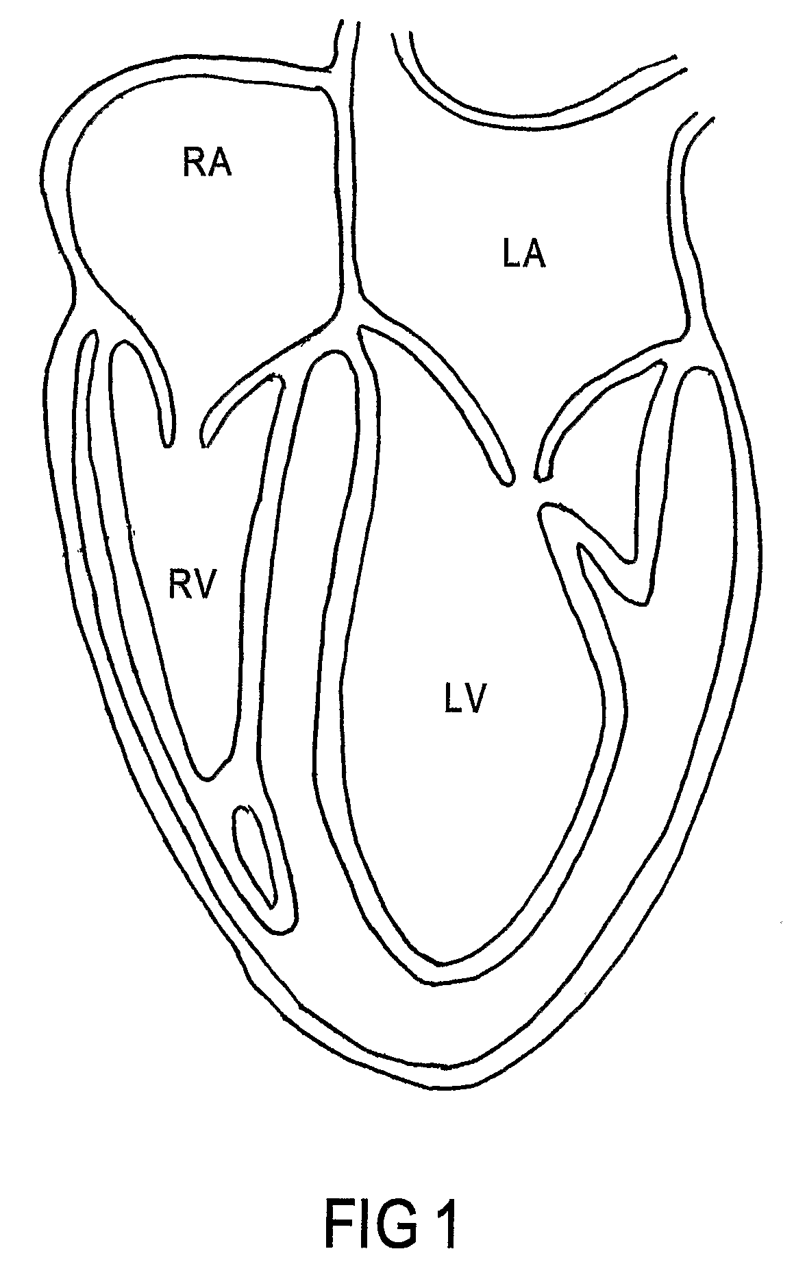 Treating Valvular Insufficiency