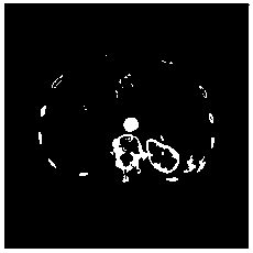 A Fusion Method of Hepatic Multiphase CT Images