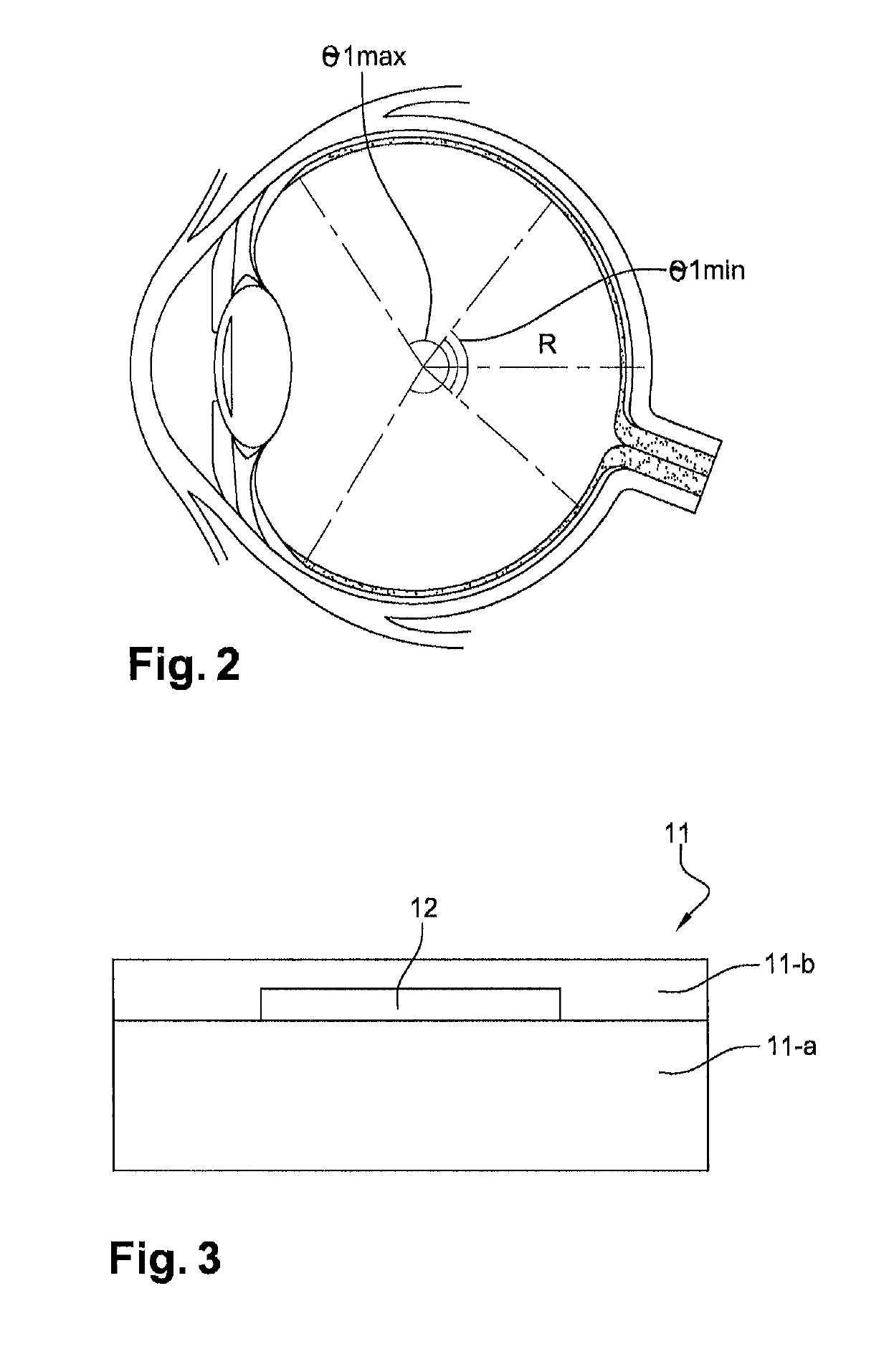 Device and method for prosthetic rehabilitation of the retina