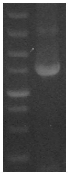 A new type of phospholipase