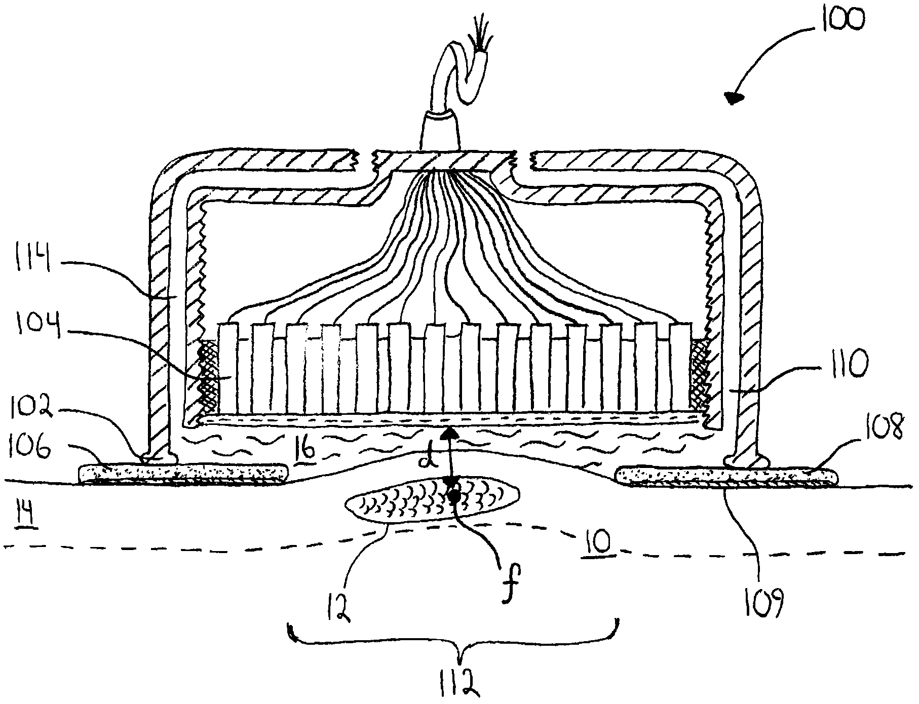 Ultrasonic surgical apparatus and silicon waveguide and methods for use thereof