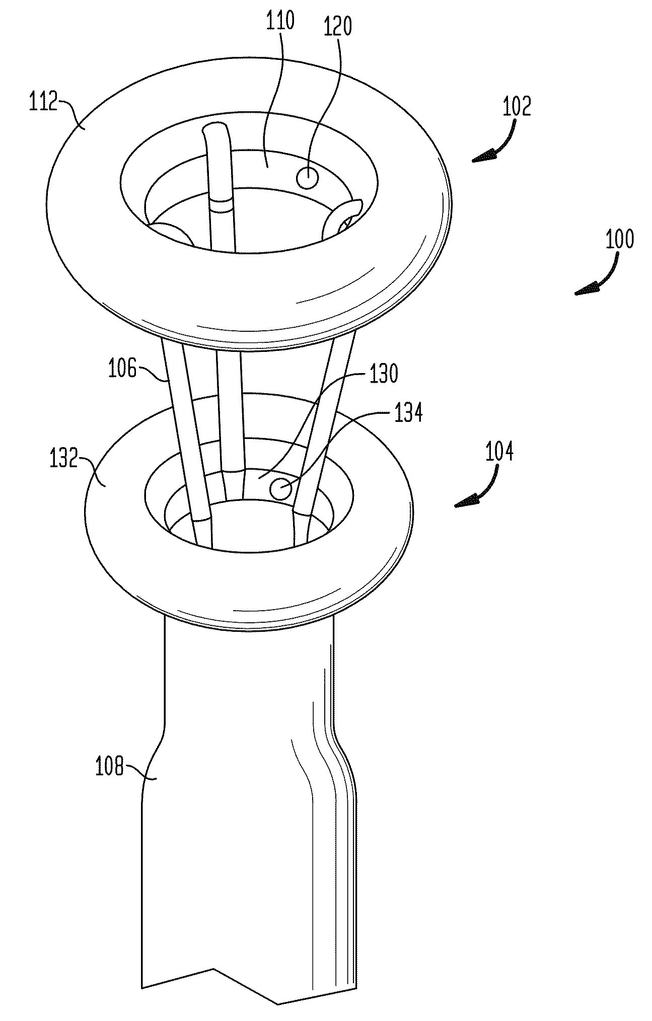 Systems and methods for treatment of obesity and type 2 diabetes