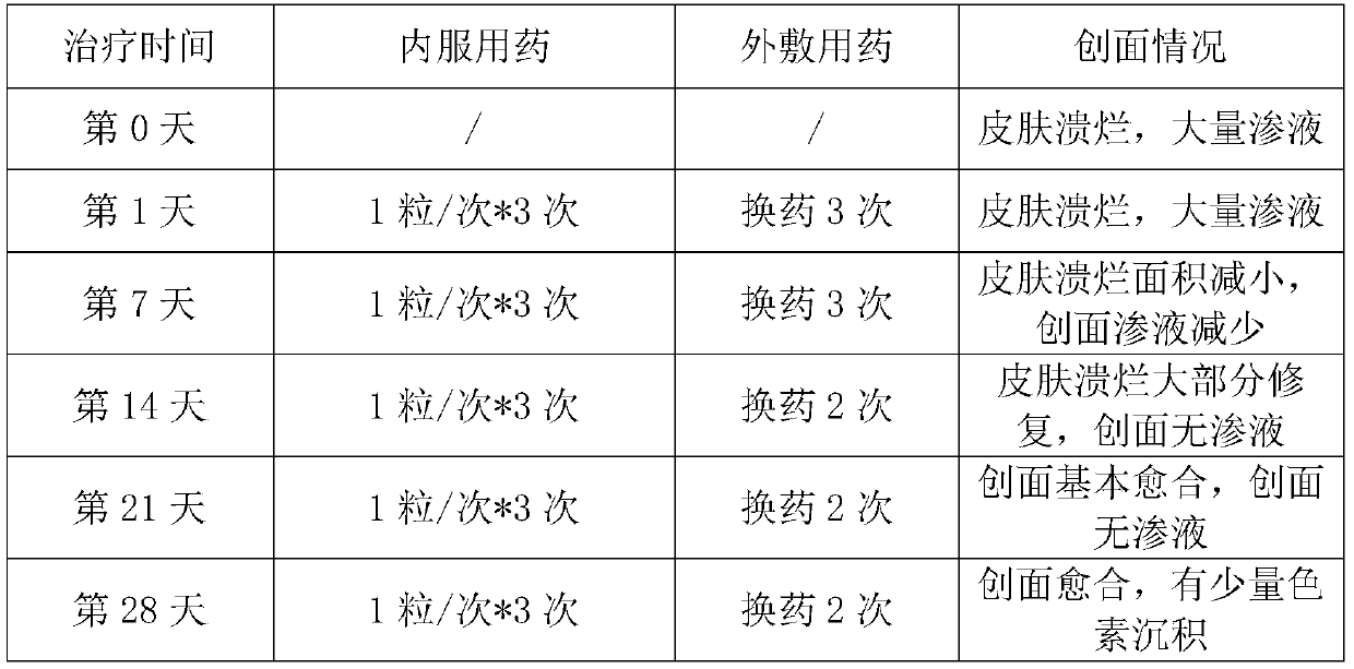 A combination drug for the treatment of diabetic refractory wound complications