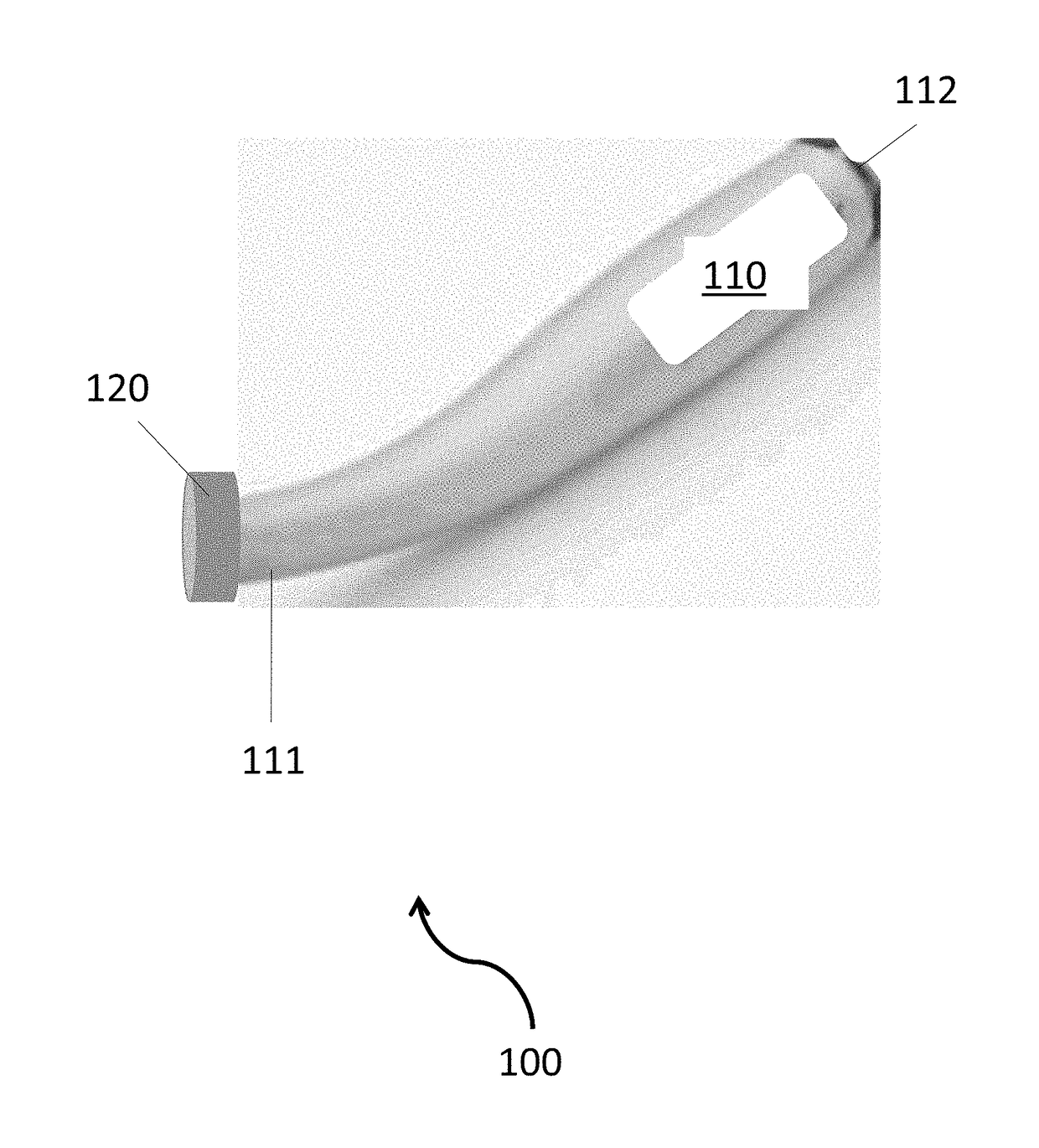 Methods and devices for application of beta radiation treatment following glaucoma surgery