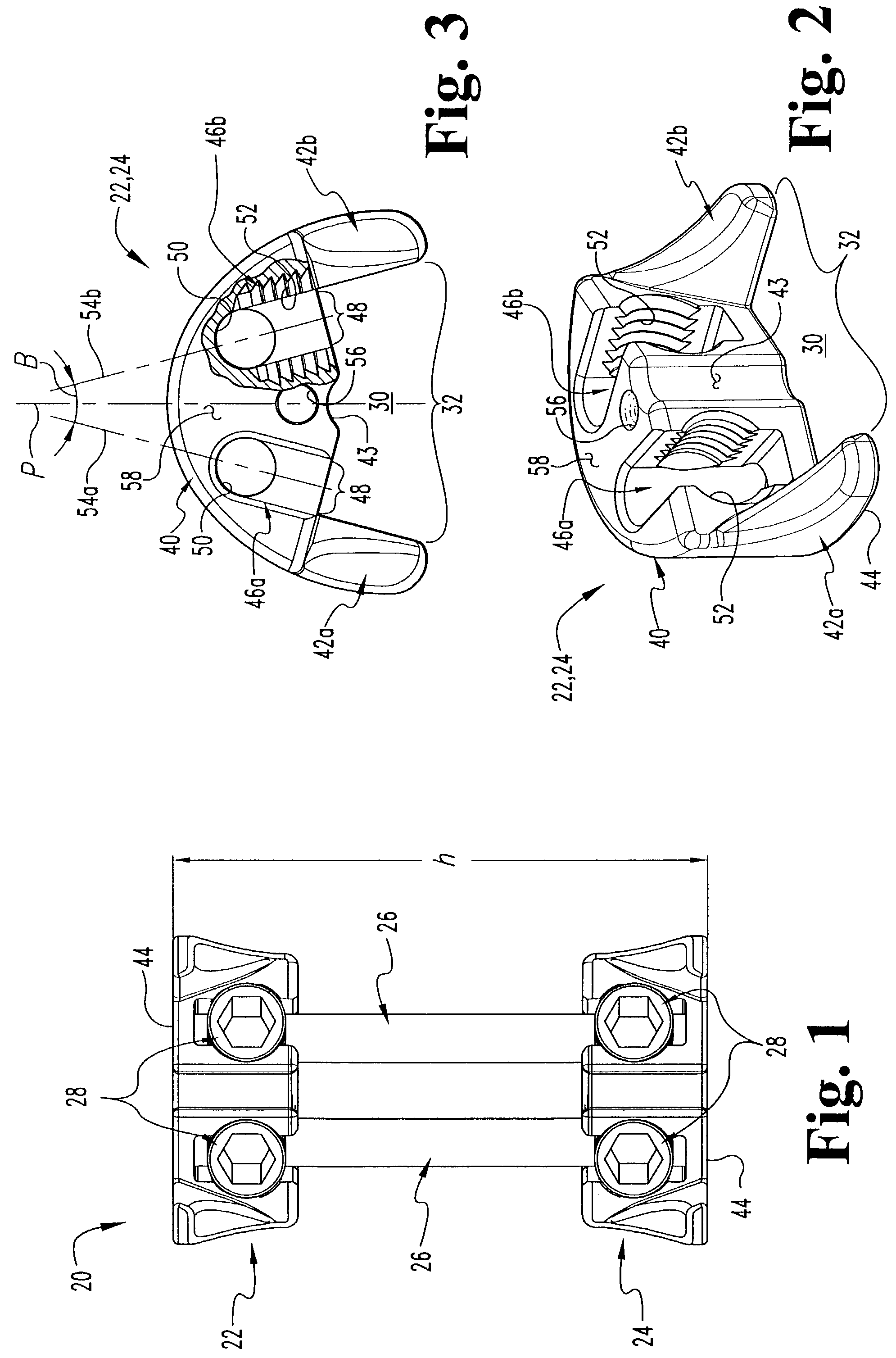 Apparatus and method for supporting vertebral bodies