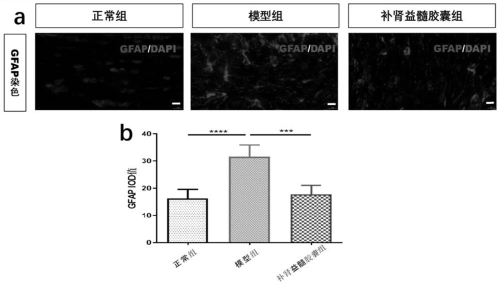 Application of kidney and marrow-tonifying capsule in treatment of optic neuritis