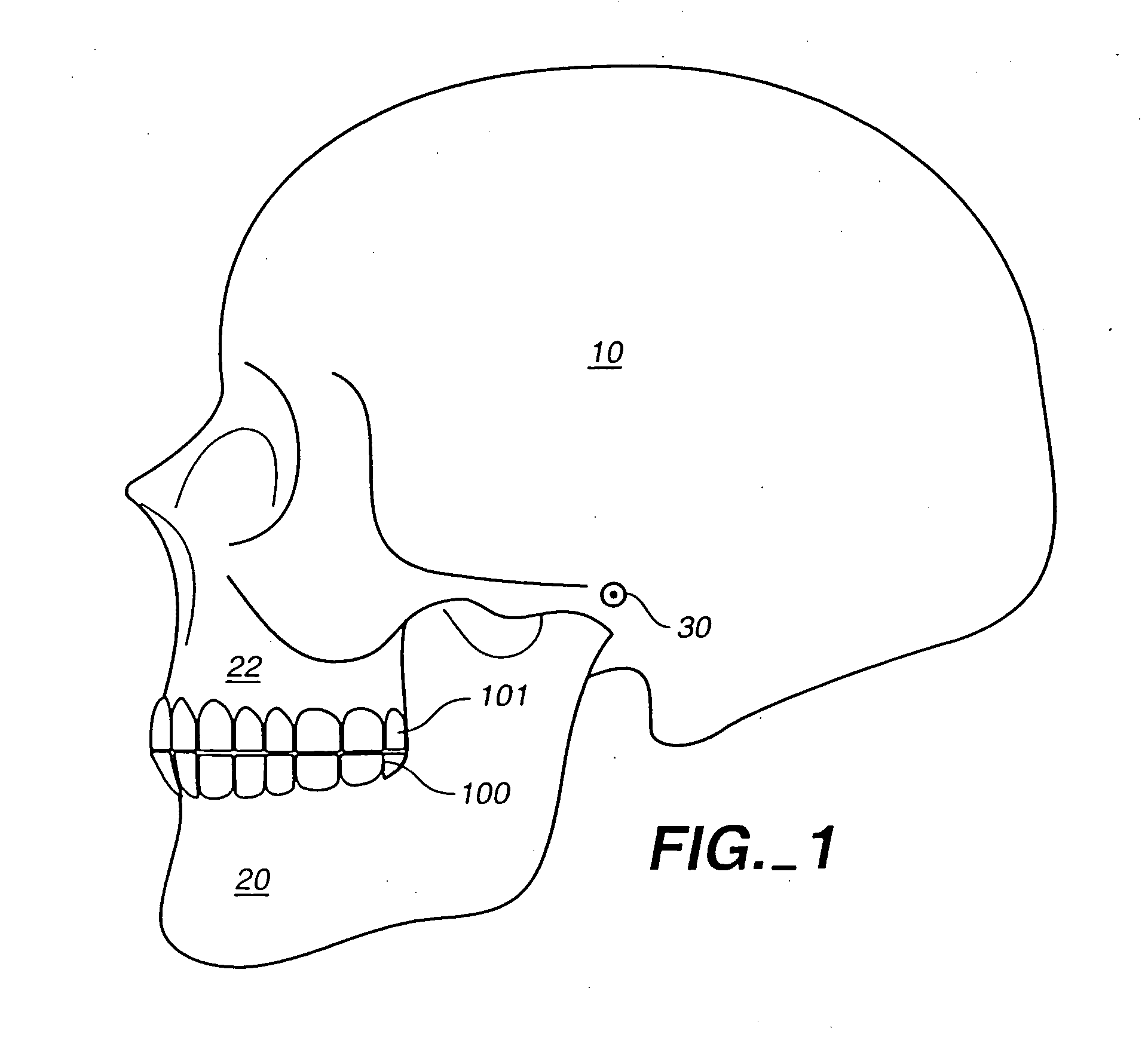 Systems and methods for positioning teeth