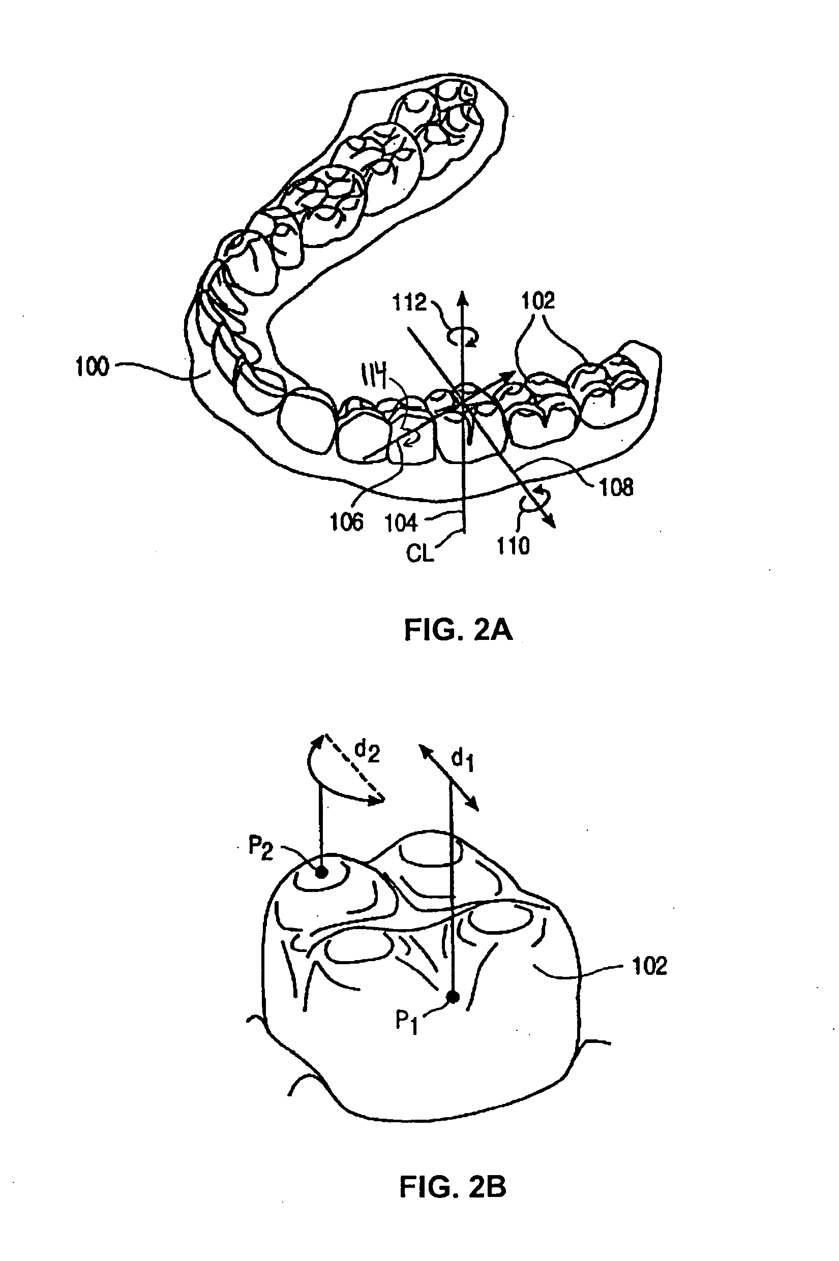 Systems and methods for positioning teeth