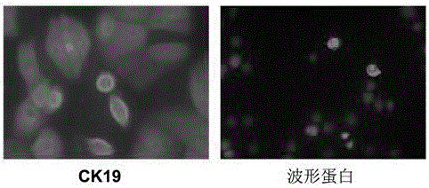 Serum-free medium of human amniotic epithelial stem cell and culture method thereof