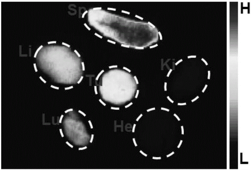 Hypoxia improvement-based cisplatin prodrug liposome preparation as well as preparation method and application thereof