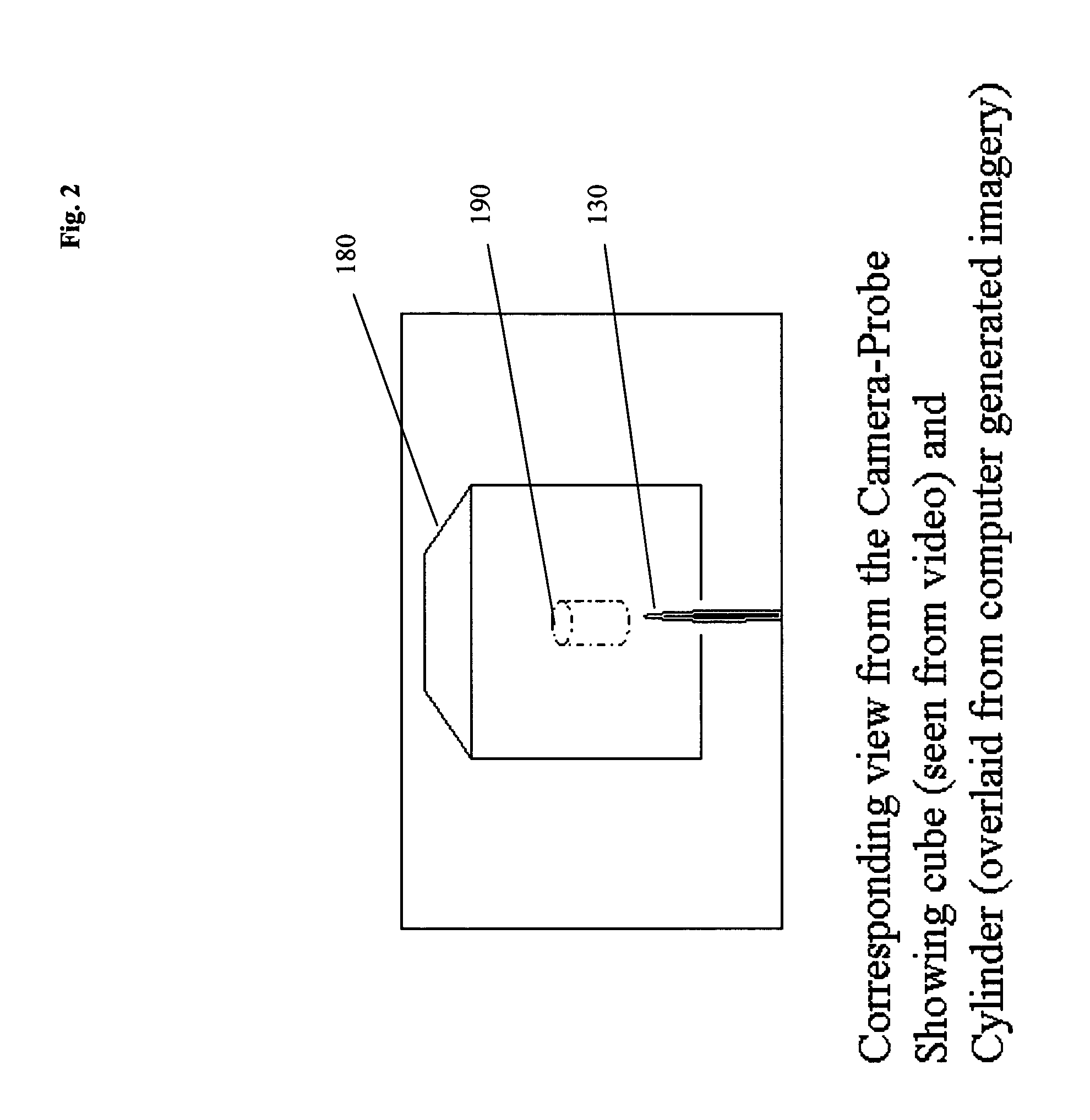 Computer enhanced surgical navigation imaging system (camera probe)