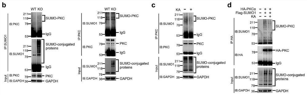 Novel cell lysis buffer solution for detecting cell ubiquitin modified proteins