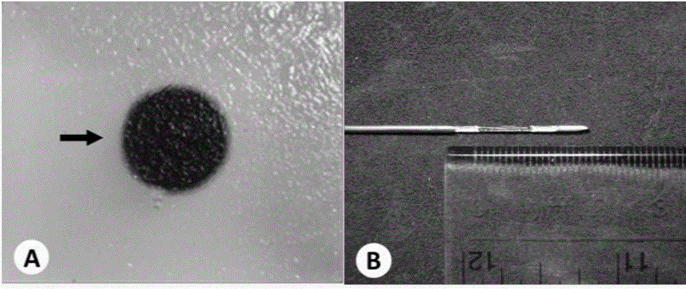 Biopsy model used for interventional ultrasound