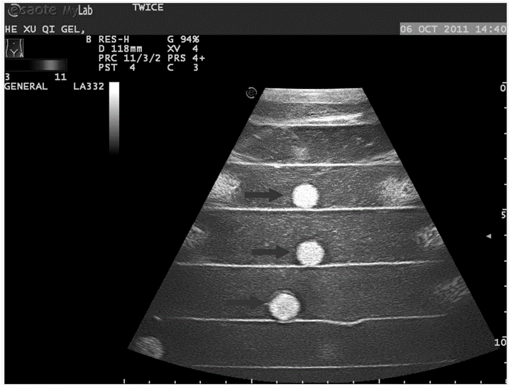 Biopsy model used for interventional ultrasound