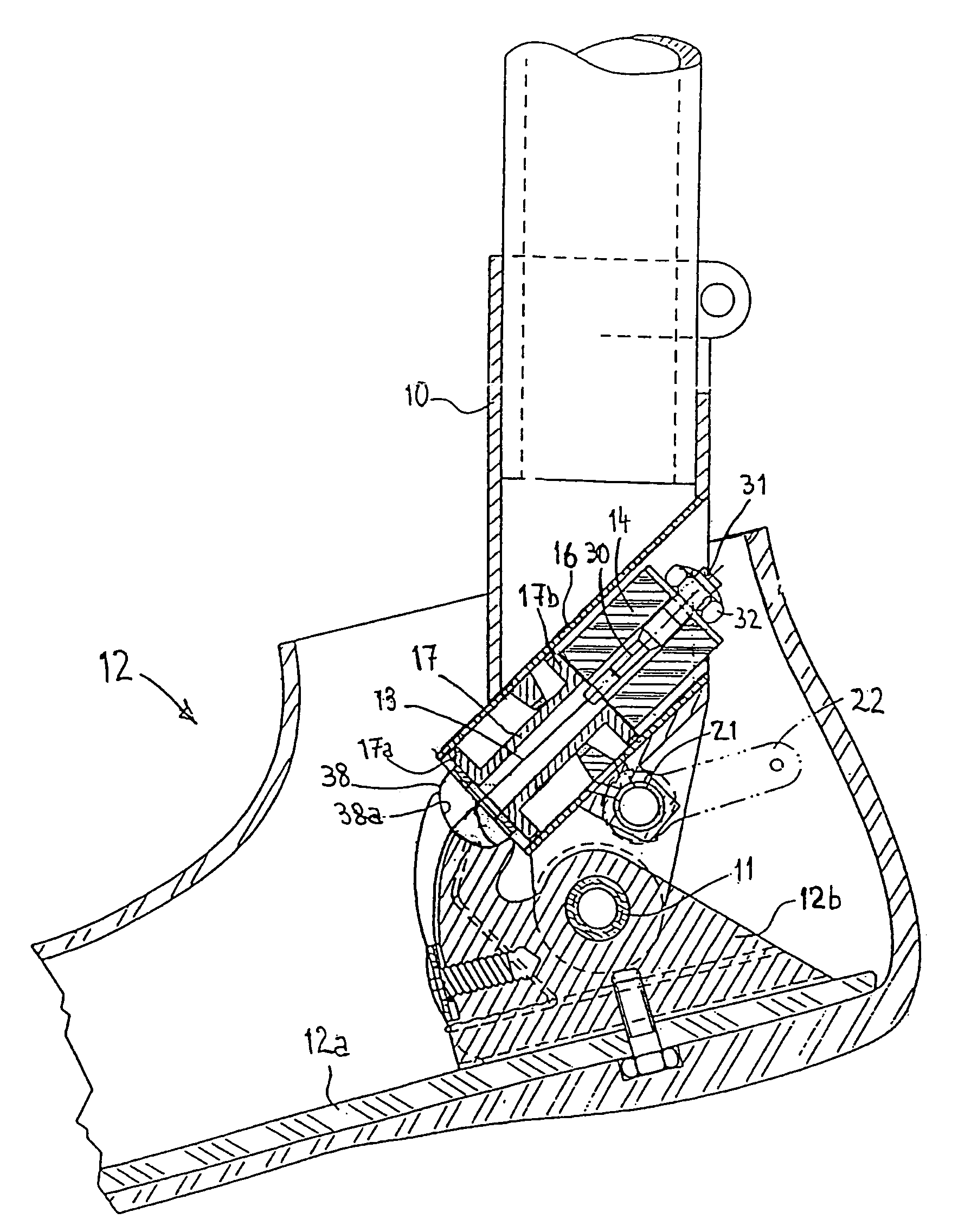 Prosthetic leg and foot apparatus