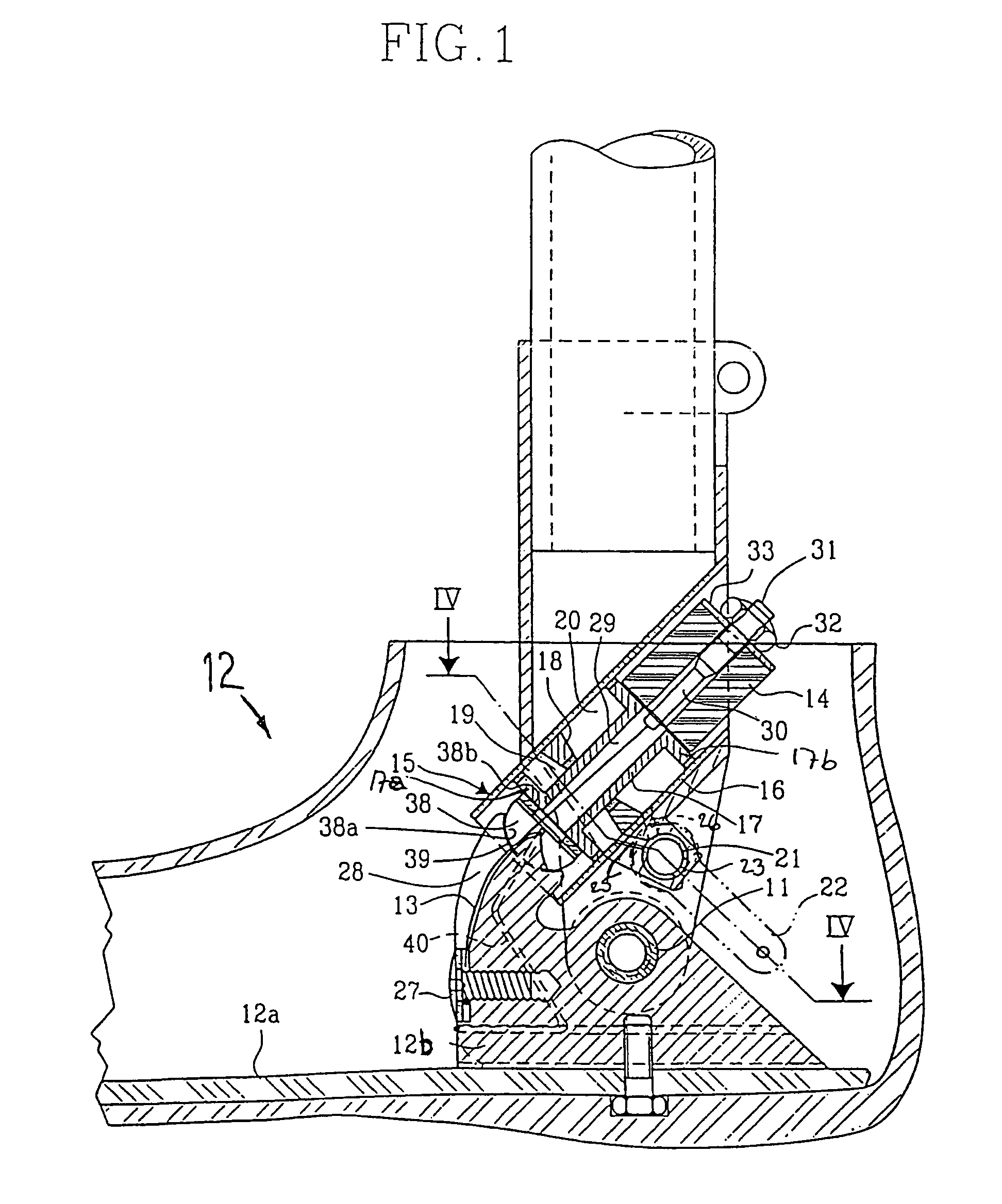 Prosthetic leg and foot apparatus