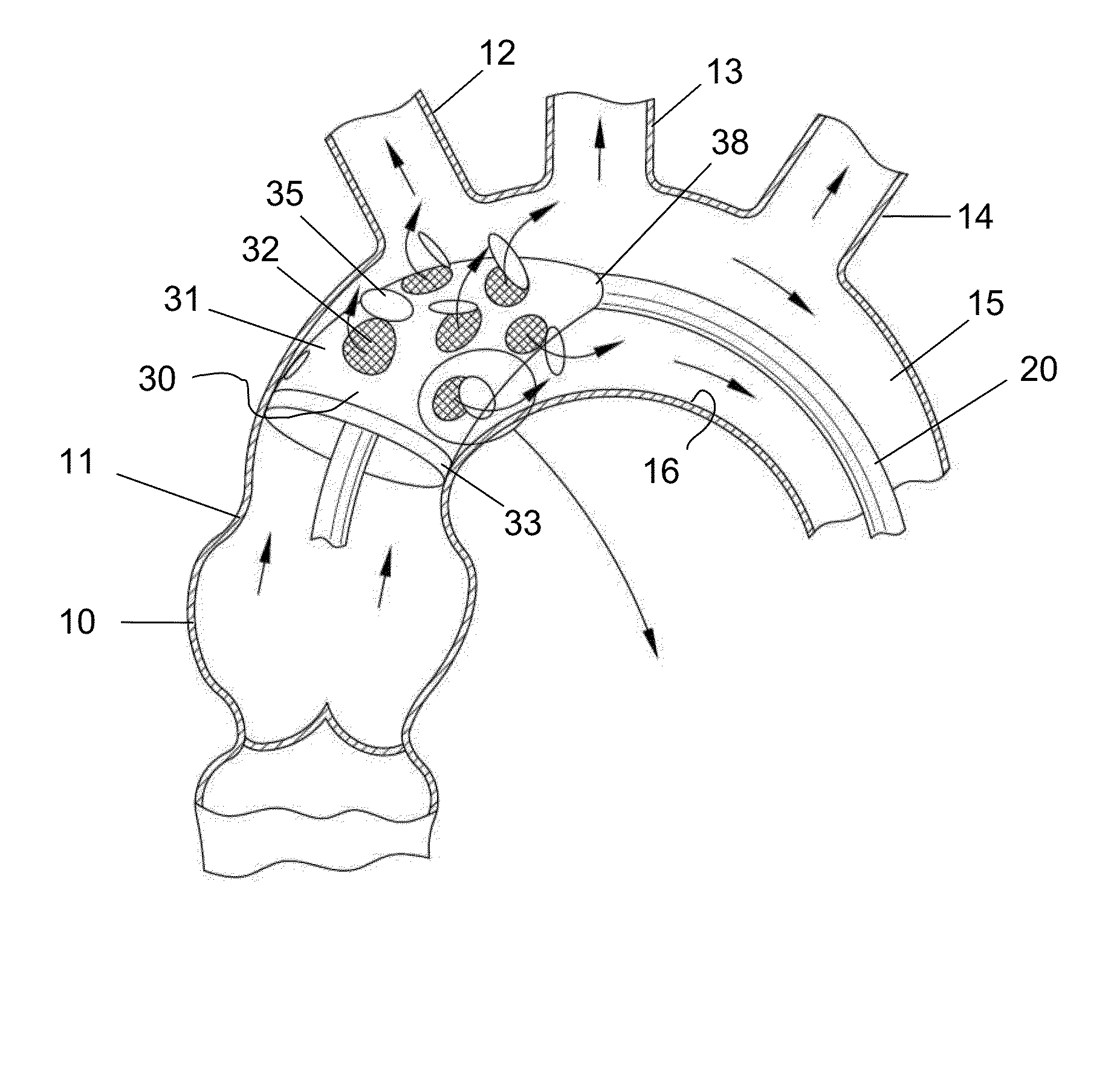 Temporary valve and valve-filter