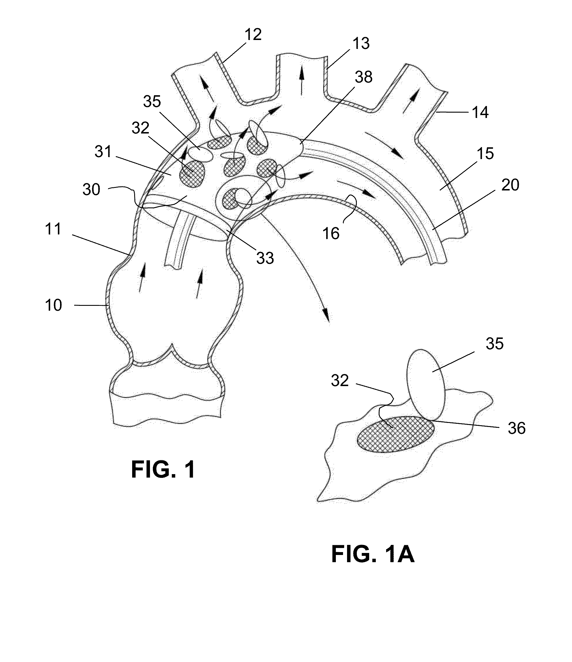 Temporary valve and valve-filter