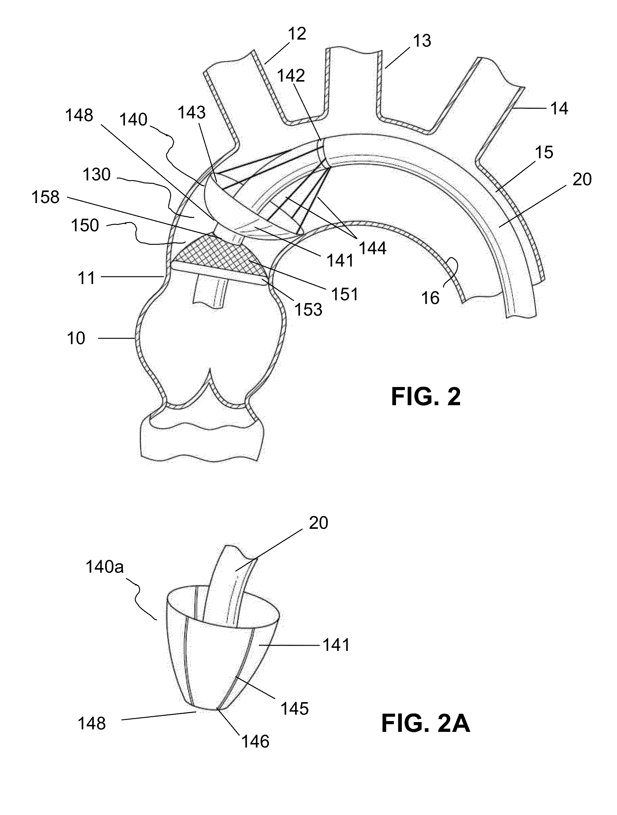 Temporary valve and valve-filter