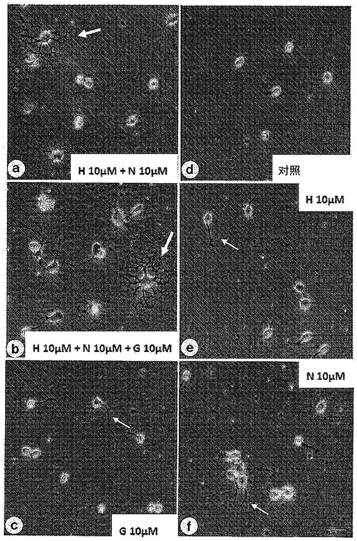 Composition for treatment and/or prevention of alzheimer's disease