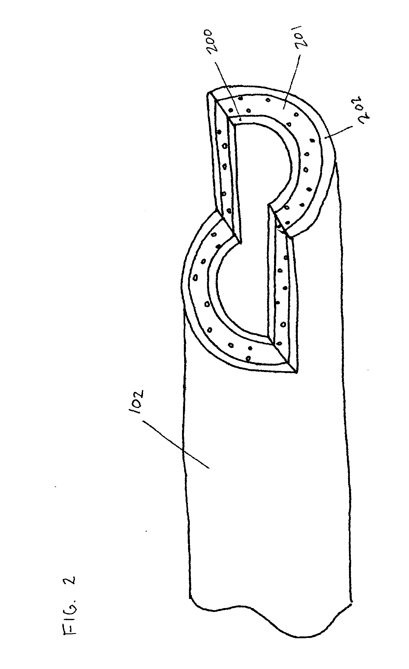 Endovascular devices and methods