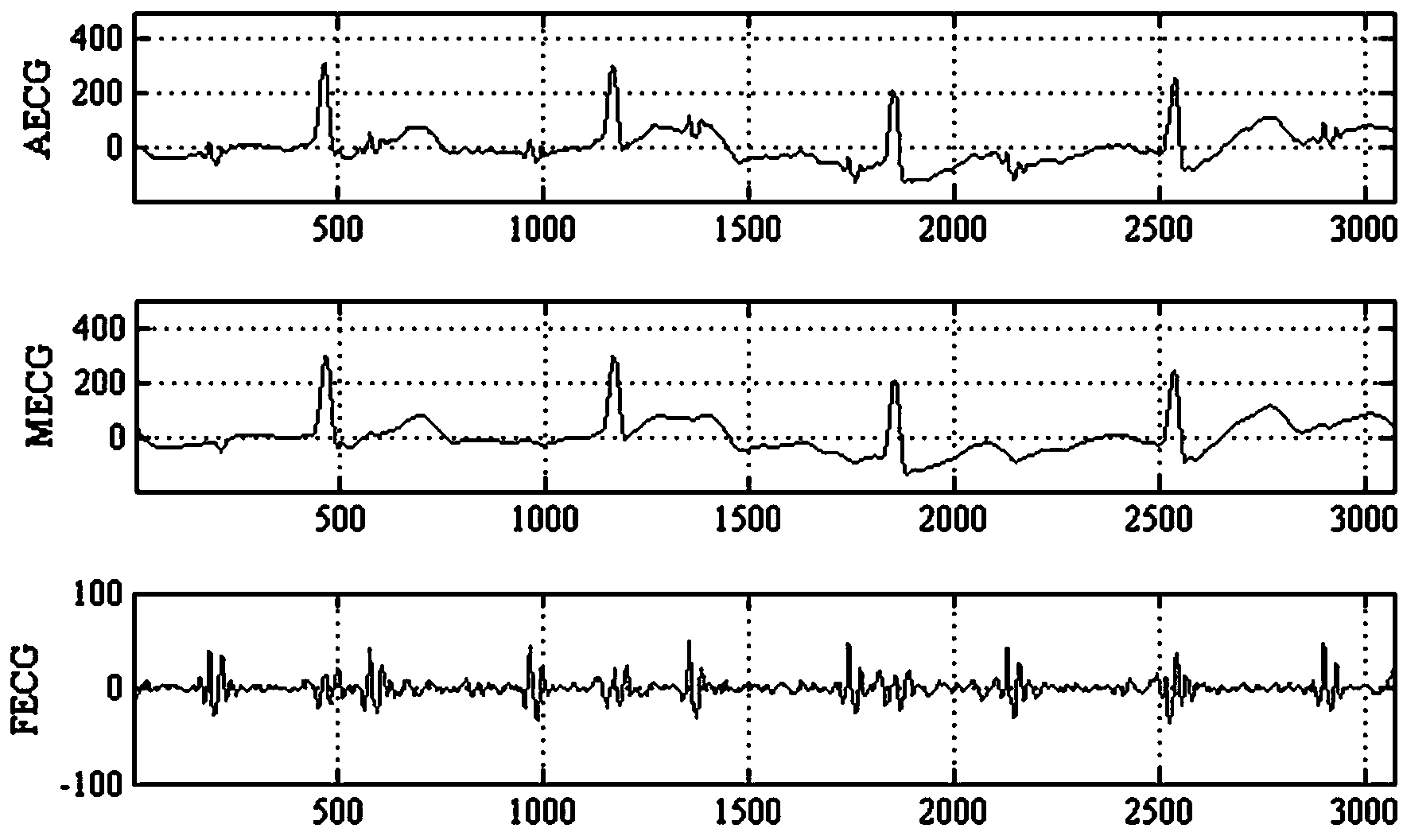 Interactive method for rapidly and automatically extracting fetus electrocardio